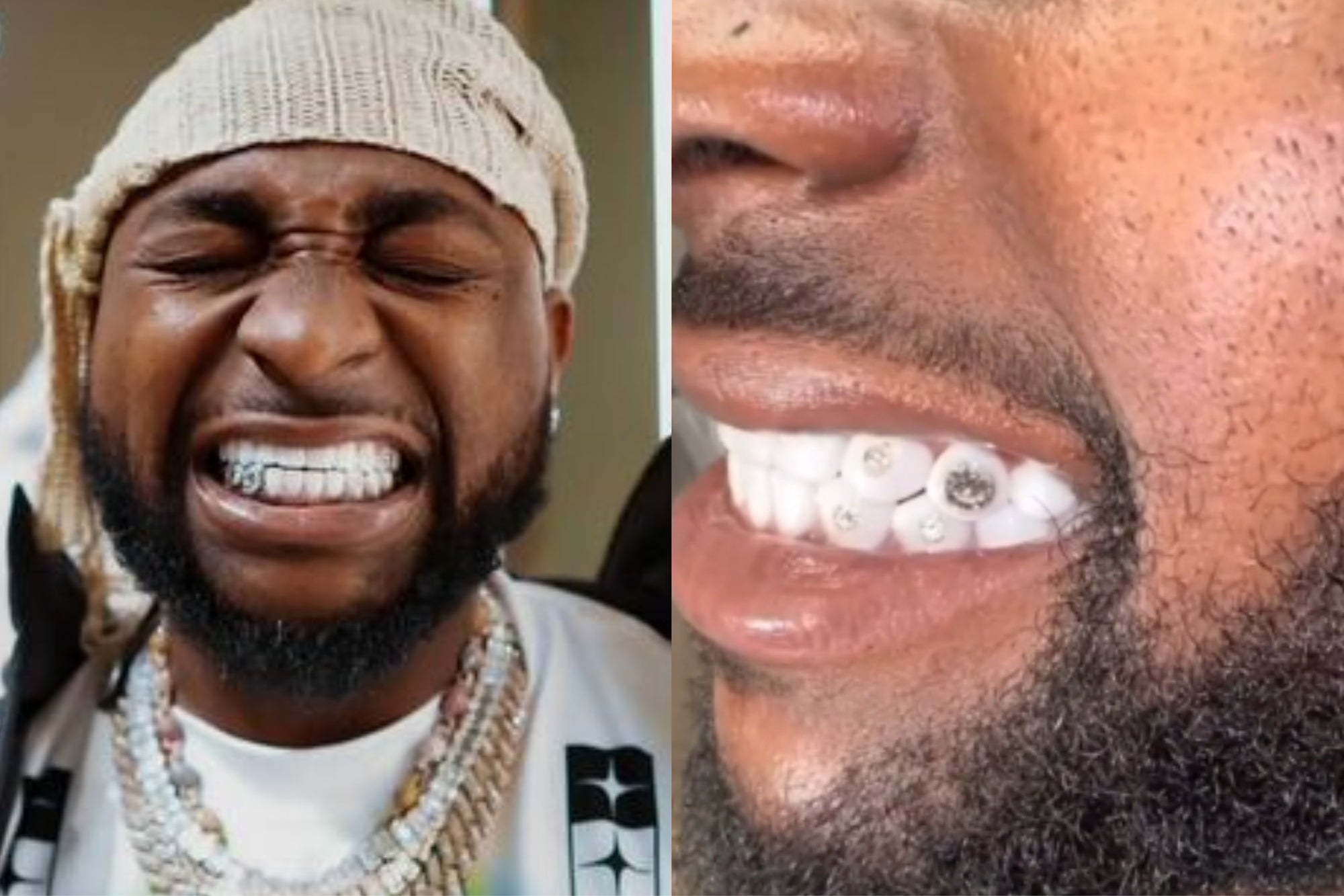 Davido Flaunts New Diamond-Encrusted Tooth in Viral Clip