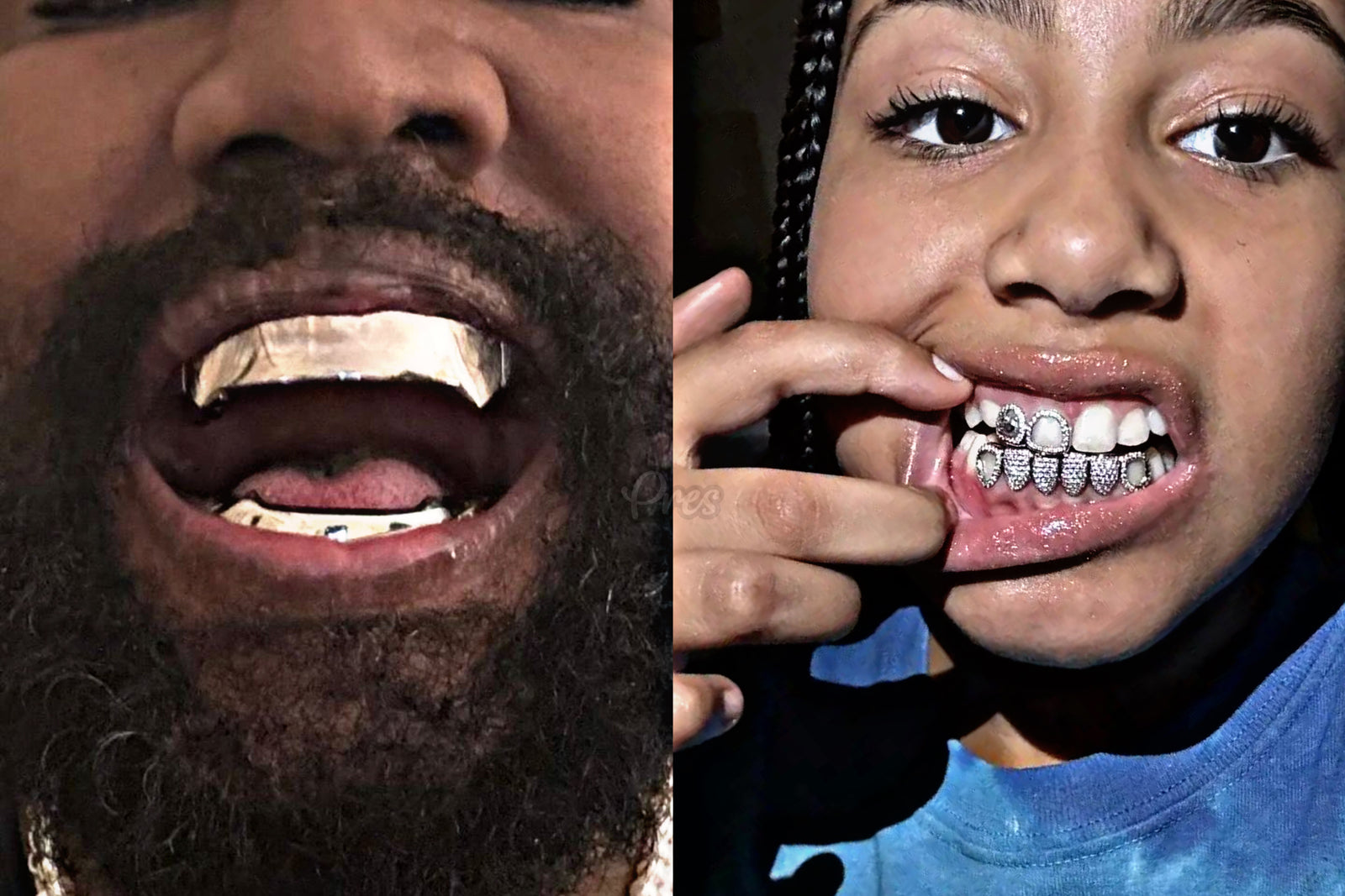 North West sports a fresh diamond grill following Kanye West's revealing his $850,000 titanium dentures - Gold Presidents
