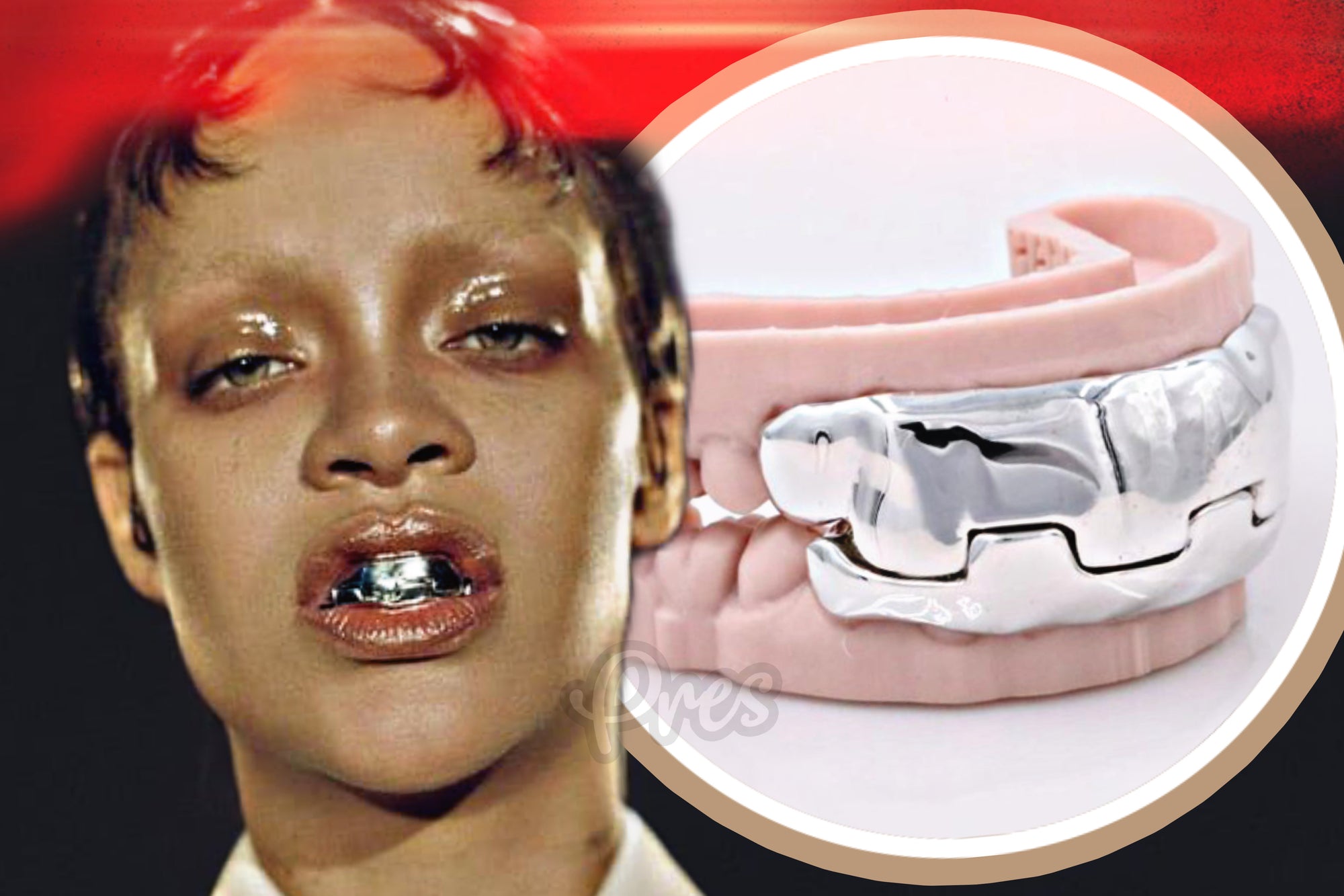 Rihanna Sports Metallic Grill Inspired by Kanye West and James Bond Villain 'Jaws'