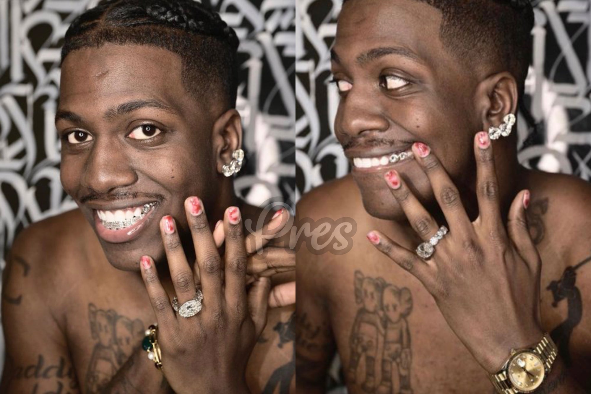 Lil Yachty Unveils Jaw-Dropping $1 Million Diamond Grills  - Gold Presidents